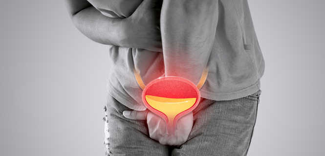 Leczenie NTM u mężczyzn taśmą