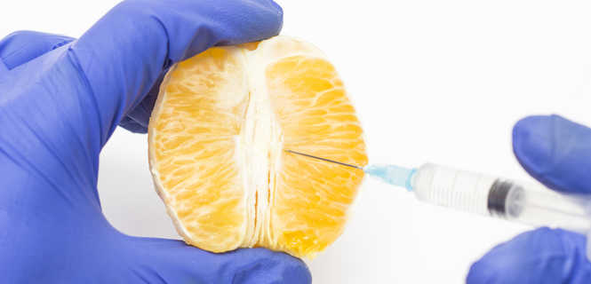 Powiększanie warg sromowych kwasem hialuronowym - co to za zabieg