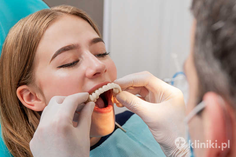 Proteza całkowita nylonowa zapewnia wysoki komfort noszenia dzięki elastycznej strukturze materiału Proteza całkowita nylonowa zapewnia wysoki komfort noszenia dzięki elastycznej strukturze materiału