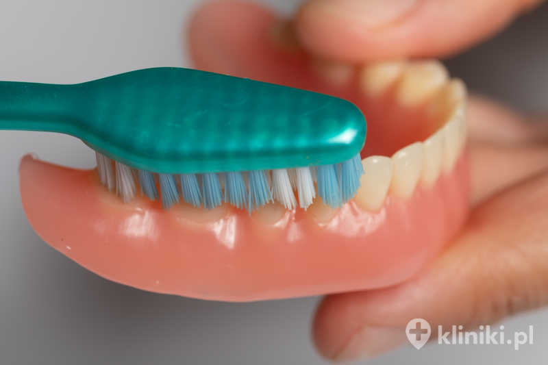 Proteza nylonowa całkowita jest bardziej odporna na uszkodzenia mechaniczne niż tradycyjne akrylowe protezy Proteza nylonowa całkowita jest bardziej odporna na uszkodzenia mechaniczne niż tradycyjne akrylowe protezy