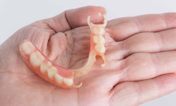 Proteza szkieletowa acetalowa jest lekkim i elastycznym uzupełnieniem protetycznym stosowanym przy brakach częściowych