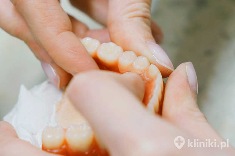 Proteza szkieletowa acetalowa zapewnia wysoki komfort noszenia dzięki elastycznym klamrom dopasowującym się do zębów