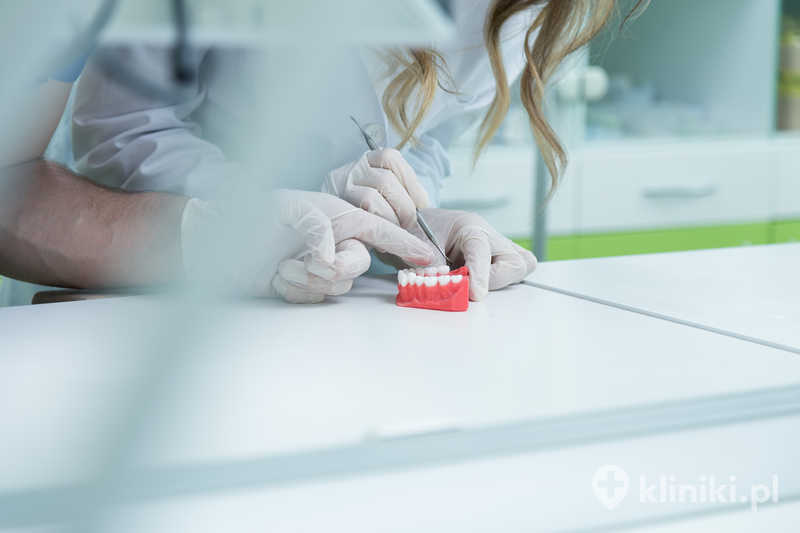 Proteza szkieletowa z acetalu jest dobrym rozwiązaniem dla pacjentów poszukujących uzupełnienia bez metalowych elementów