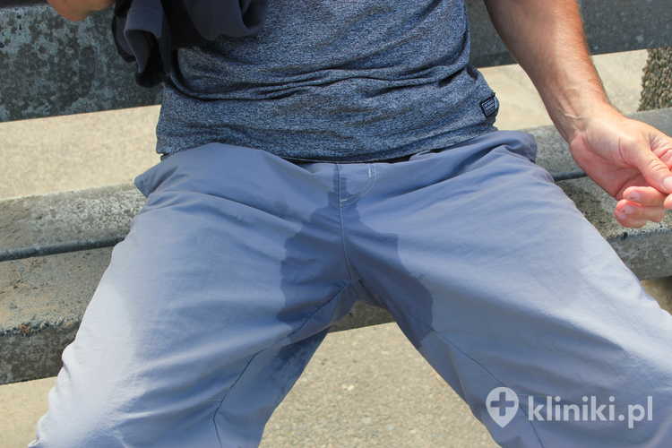 Taśmy stosowane w leczeniu WNM