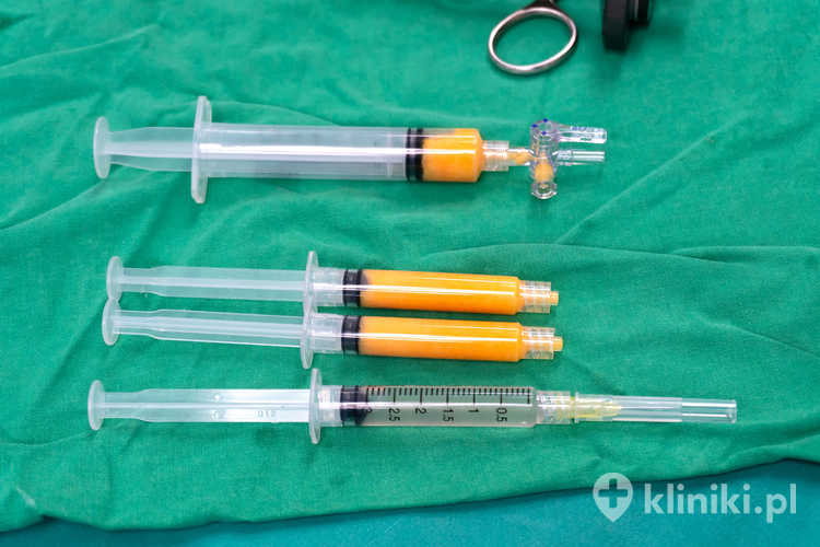 Terapia LIPOGEMS znajduje zastosowanie w leczeniu schorzeń ortopedycznych, takich jak uszkodzenia ścięgien czy choroba zwyrodnieniowa stawów