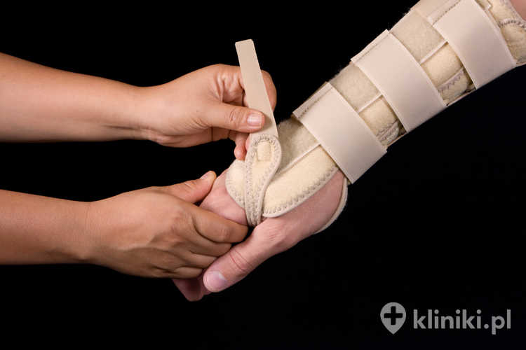 Zapobieganie nawrotom zespołu cieśni nadgarstka