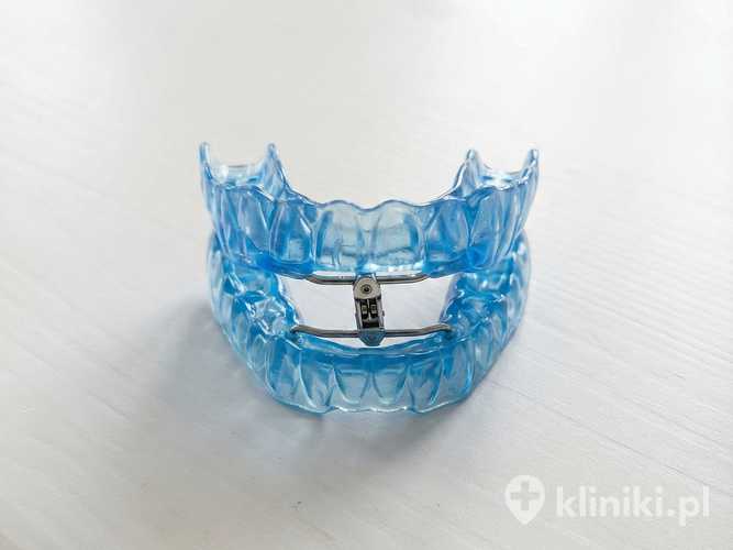 Leczenie chrapania aparatem TAP-T polega na wysunięciu żuchwy do przodu, co poszerza przestrzeń w gardle i ułatwia przepływ powietrza