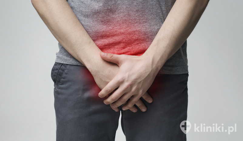 Powikłania po embolizacji tętnic stercza