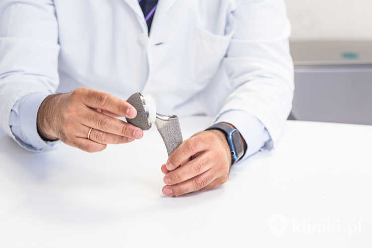 Trwałość endoprotezy stawu biodrowego jest większa u pacjentów przestrzegających zaleceń dotyczących obciążania i aktywności fizycznej