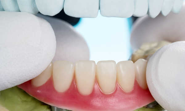 ChatGPT powiedział:
Mosty dentystyczne umożliwiają uzupełnienie brakujących zębów, przywracając funkcję żucia i estetykę uśmiechu ChatGPT powiedział:
Mosty dentystyczne umożliwiają uzupełnienie brakujących zębów, przywracając funkcję żucia i estetykę uśmiechu