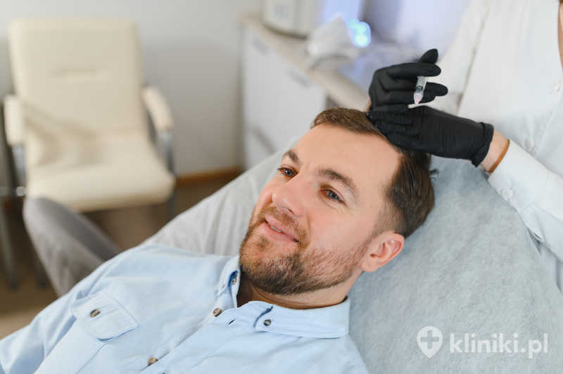 Leczenie łysienia metodą PRP stymuluje mieszki włosowe do wzrostu dzięki czynnikom wzrostu uwalnianym z płytek krwi Leczenie łysienia metodą PRP stymuluje mieszki włosowe do wzrostu dzięki czynnikom wzrostu uwalnianym z płytek krwi