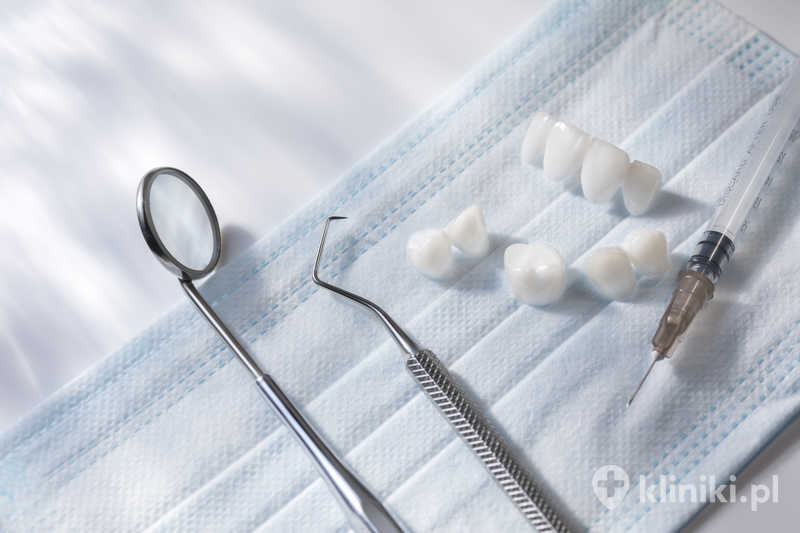 Licówka pełnoceramiczna zapewnia bardzo naturalną estetykę dzięki znakomitemu odwzorowaniu koloru i przezierności szkliwa Licówka pełnoceramiczna zapewnia bardzo naturalną estetykę dzięki znakomitemu odwzorowaniu koloru i przezierności szkliwa