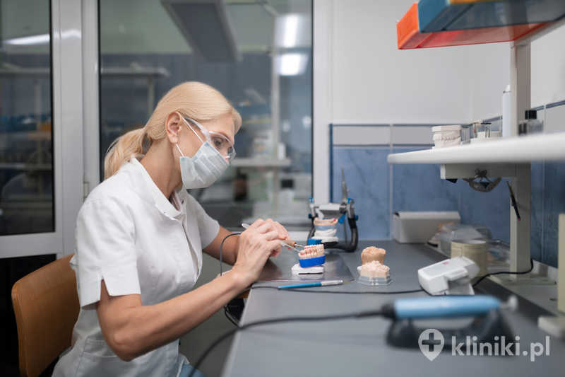 Licówka porcelanowa ultracienka odznacza się dużą trwałością i odpornością na ścieranie, co wydłuża jej żywotność