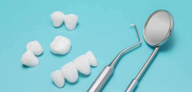 Licówka porcelanowa ultracienka (bez szlifowania)