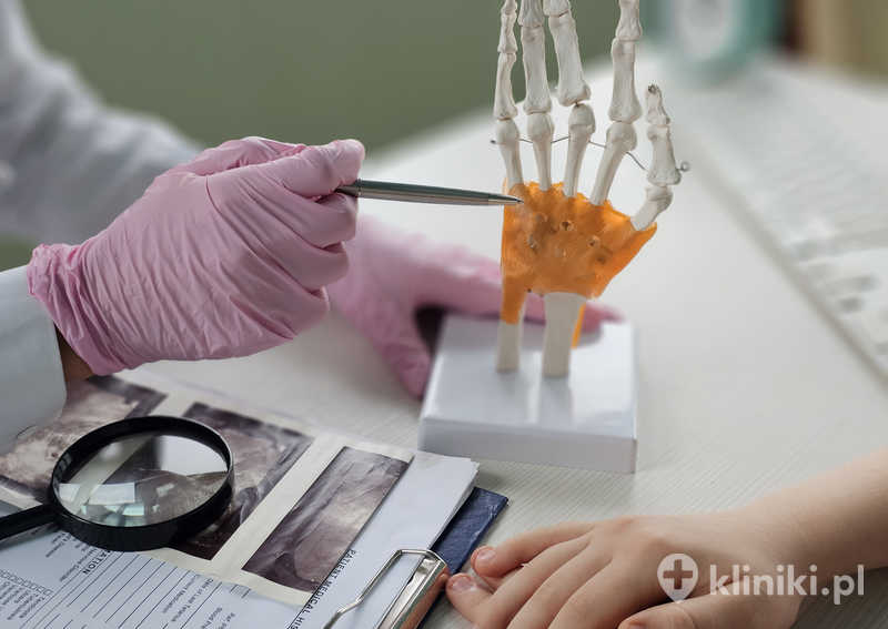 Operacja otwarta zespołu cieśni kanału nadgarstka wykonywana jest w znieczuleniu miejscowym i trwa zwykle kilkanaście minu