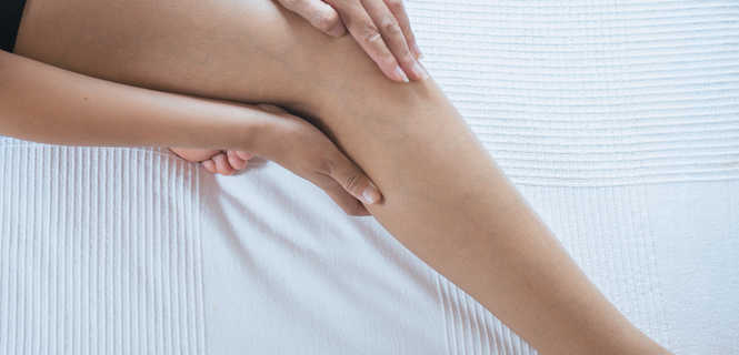 Zalety chemoobliteracji żylaków Flebogrif