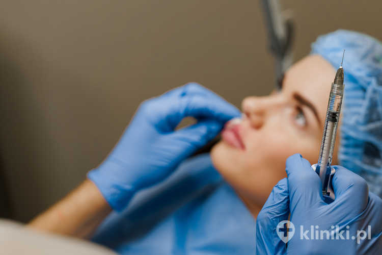 Kwas hialuronowy w zabiegach medycyny estetycznej