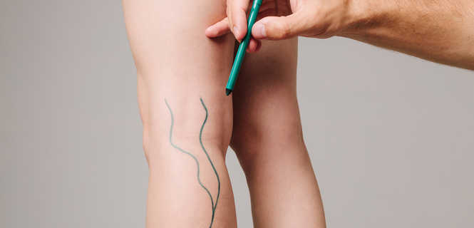 Czy do chirurga naczyniowego trzeba mieć skierowanie?