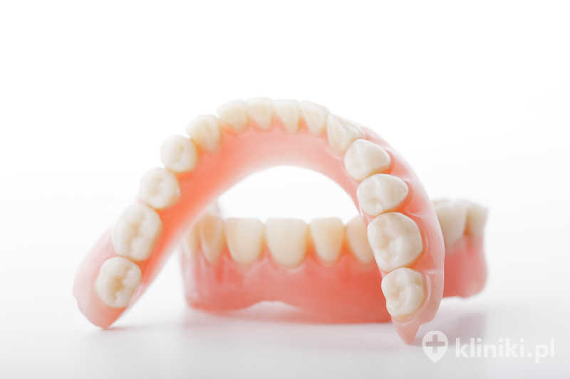 Mosty dentystyczne opierają się na zębach filarowych lub implantach, zapewniając stabilne podparcie Mosty dentystyczne opierają się na zębach filarowych lub implantach, zapewniając stabilne podparcie