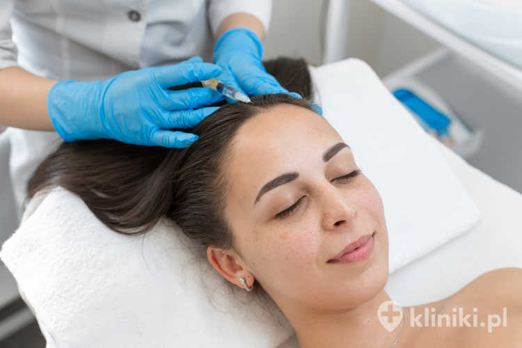 Osocze bogatopłytkowe PRP