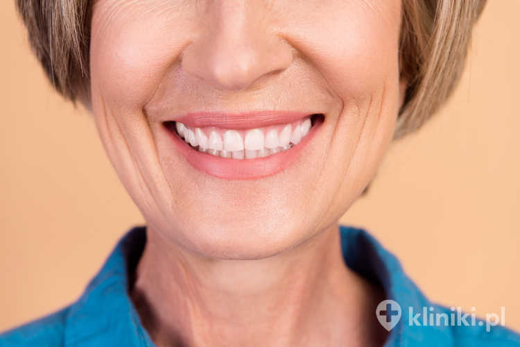 Porównanie protezy na implantach i pracy stałej powinno uwzględniać ilość kości, stan zdrowia pacjenta oraz jego oczekiwania estetyczne