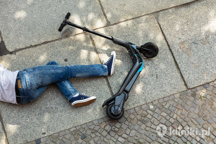 Skutki jazdy na hulajnodze elektrycznej