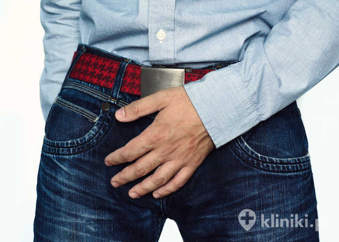 Żylaki powrózka nasiennego