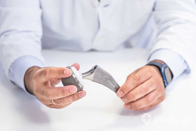 Endoprotezy stawu biodrowego dzielą się również na całkowite, zastępujące panewkę i głowę kości udowej, oraz częściowe, obejmujące tylko jeden element stawu