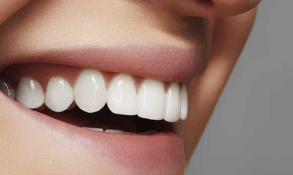 Korona porcelanowa na podbudowie metalowej charakteryzuje się wysoką wytrzymałością mechaniczną i dobrą trwałością kliniczną Korona porcelanowa na podbudowie metalowej charakteryzuje się wysoką wytrzymałością mechaniczną i dobrą trwałością kliniczną