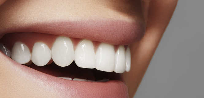 Korona porcelanowa na podbudowie metalowej