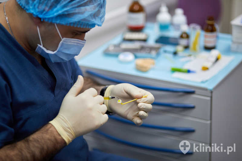 Korona porcelanowa na podbudowie metalowej jest rozwiązaniem sprawdzonym od lat i nadal znajduje szerokie zastosowanie w nowoczesnej protetyce stomatologicznej Korona porcelanowa na podbudowie metalowej jest rozwiązaniem sprawdzonym od lat i nadal znajduje szerokie zastosowanie w nowoczesnej protetyce stomatologicznej