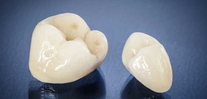 Korona porcelanowa pełnoceramiczna