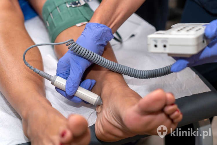 Skuteczne leczenie przyczynowe żylaków kończyn dolnych dobierane jest indywidualnie na podstawie badania USG Doppler