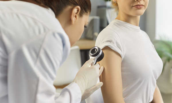 Jakimi metodami można usunąć znamię barwnikowe?