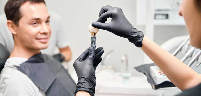 Implanty zębowe Direct