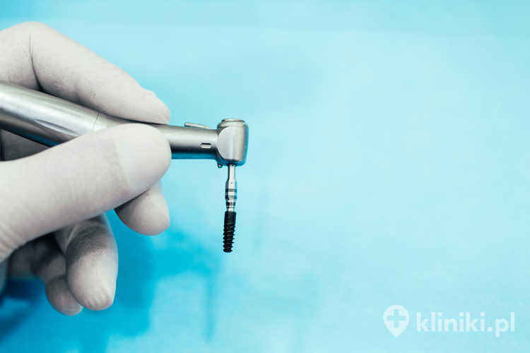 Implanty zębowe Direct wykorzystują sprawdzone materiały i standardowe połączenia implant–łącznik