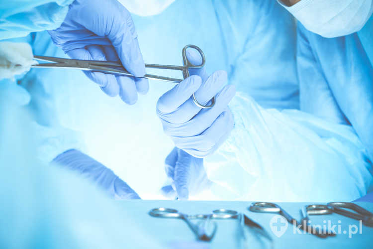 Operacja przepukliny brzusznej z użyciem siatki może być wykonana techniką klasyczną lub laparoskopową w zależności od wielkości i lokalizacji przepukliny