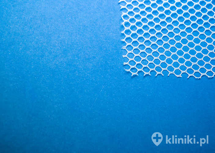 Przepuklina nawrotowa zwykle wymaga ponownej diagnostyki i nierzadko leczenia operacyjnego