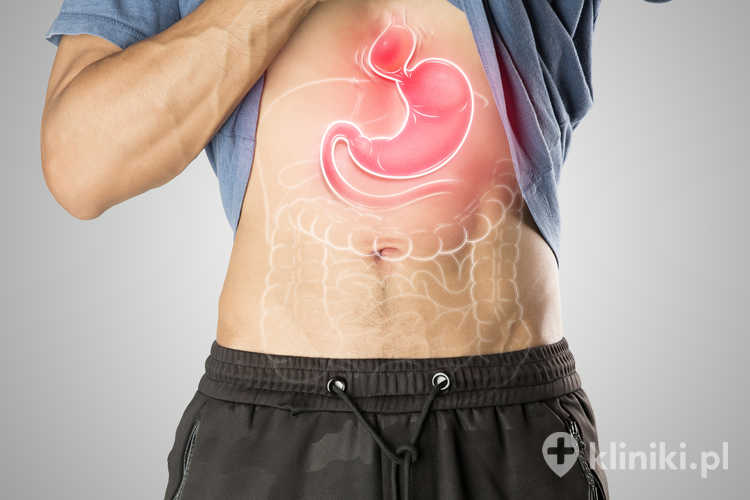 Przepukliny nabyte rozwijają się w ciągu życia pod wpływem osłabienia tkanek i wzrostu ciśnienia w jamie brzusznej