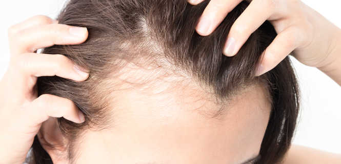 Przeszczep włosów metodą S.A.F.E.R.