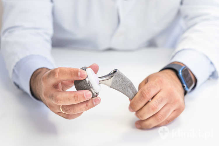 Rehabilitacja po alloplastyce biodra rozpoczyna się już następnego dnia po operacji