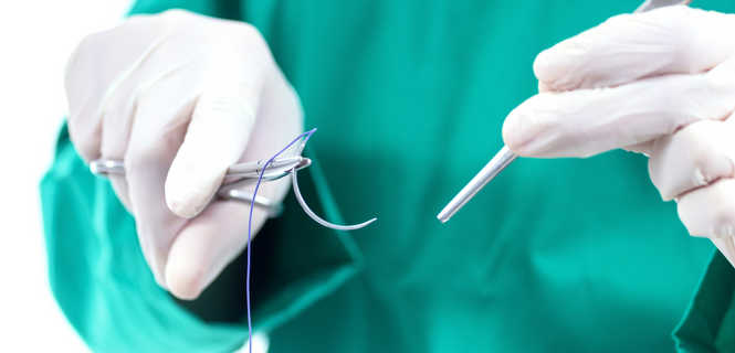 Drobne zabiegi chirurgiczne