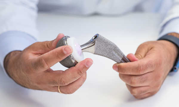 Endoproteza stawu biodrowego zastępuje uszkodzone elementy stawu, przejmując ich funkcję ruchową