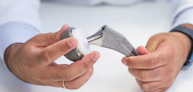 Jak działa endoproteza stawu biodrowego?