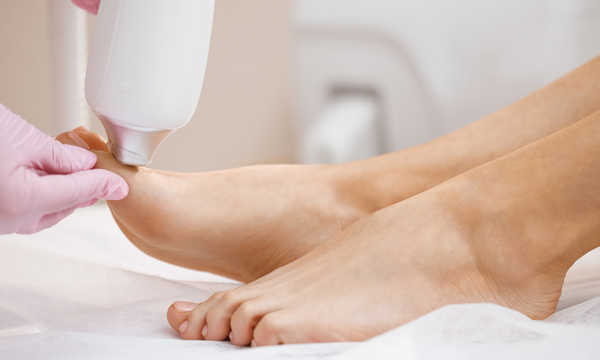 Laserowe usuwanie grzybicy paznokci jest wykonywane ambulatoryjnie i trwa zazwyczaj kilkanaście minut Laserowe usuwanie grzybicy paznokci jest wykonywane ambulatoryjnie i trwa zazwyczaj kilkanaście minut