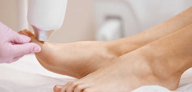 Leczenie grzybicy paznokci