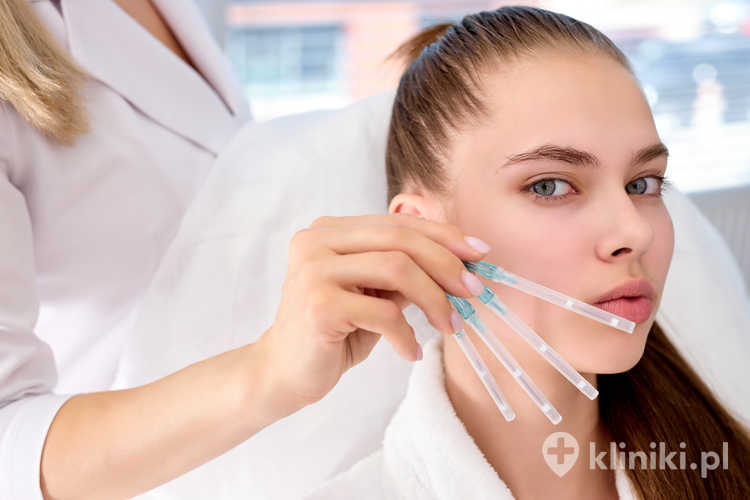 Nici liftingujące dzielą się na różne rodzaje w zależności od materiału, z którego są wykonane, m.in. PDO, PLLA oraz PCL.