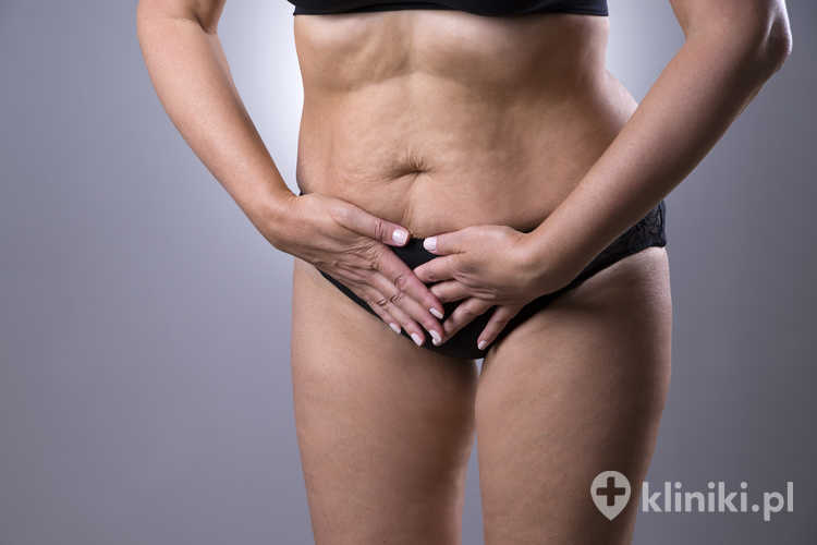 Operacyjne metody leczenia nietrzymania moczu