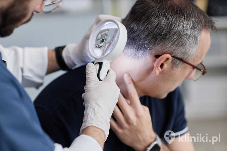 Systematyczna pielęgnacja skóry głowy po przeszczepie włosów powinna być prowadzona zgodnie z indywidualnymi zaleceniami specjalisty