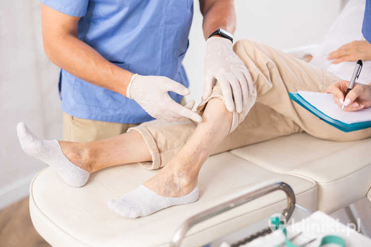 Wizyta flebologiczna pozwala ocenić stan układu żylnego oraz dobrać najbezpieczniejszą metodę leczenia